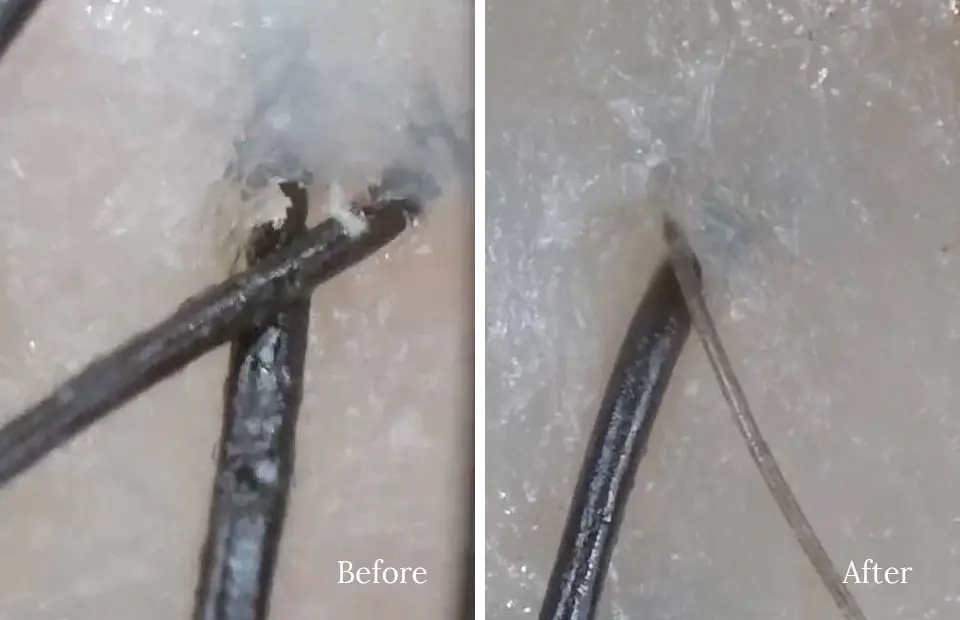 頭皮集中ケアトリートメントコース